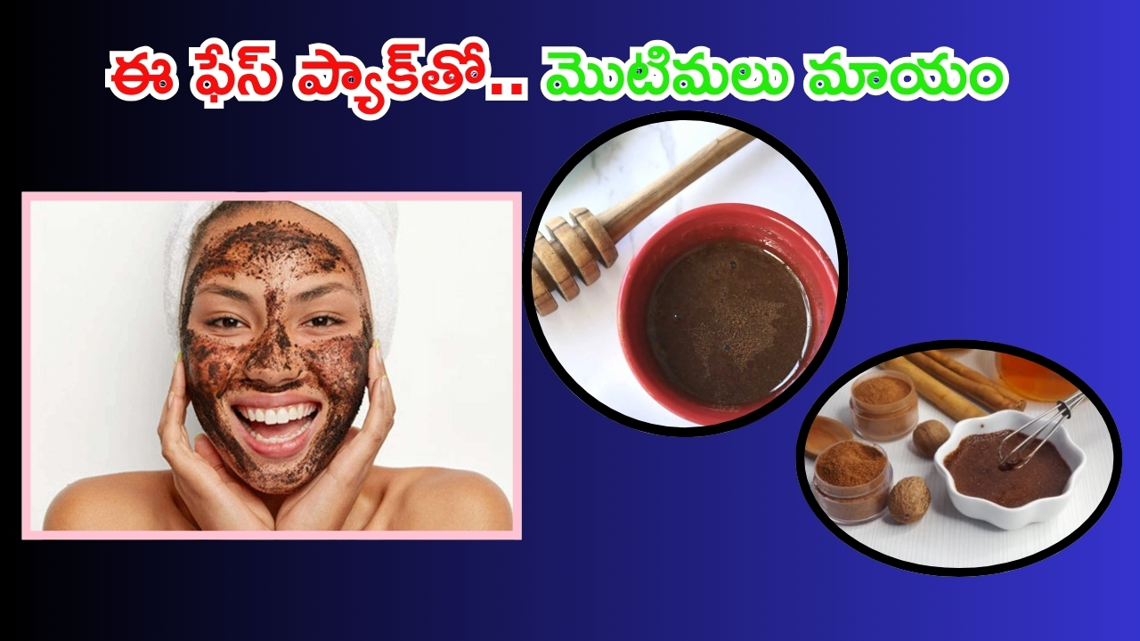 Cinnamon Face Pack: ఈ ఫేస్ ప్యాక్‌‌తో ముఖంపై మొటిమలు మాయం