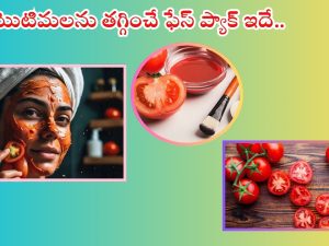 Tomato For Skin: ముఖంపై మొటిమలు తగ్గించే ఫేస్ ప్యాక్ ఇదే..