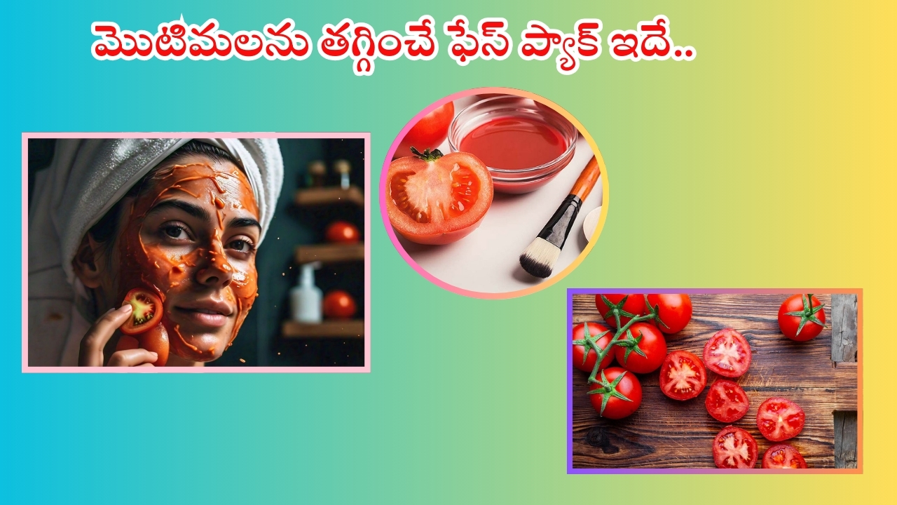 Tomato For Skin: ముఖంపై మొటిమలు తగ్గించే ఫేస్ ప్యాక్ ఇదే..