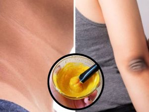 Dark Neck Elbows: వీటితో మెడ, మోచేతులపై ఉన్న నలుపు మాయం