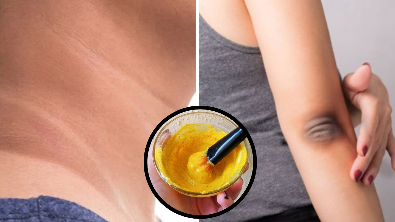 Dark Neck Elbows: వీటితో మెడ, మోచేతులపై ఉన్న నలుపు మాయం