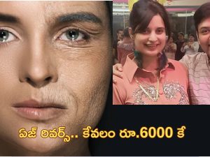 Israel Age Reverse Scam: ’60 ఏళ్ల ముసలివాళ్లను 25 ఏళ్ల యువకులుగా మార్చేసే మెషీన్’.. కోట్లు సంపాదించిన దంపతులు!