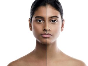 Skin Discoloration: మీ చర్మం క్రమంగా రంగు మారుతోందా.. కారణాలివే!