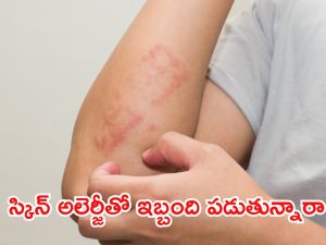 Skin Allergy : స్కిన్ అలర్జీతో ఇబ్బంది పడుతున్నారా ? వీటిని వాడండి