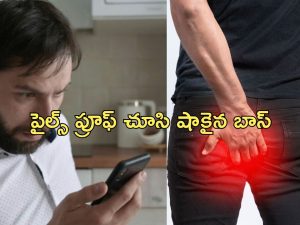 Leave For Piles: ‘నీకు పైల్స్ ఉందని ఆధారం చూపించు’.. లీవ్ అడిగినందుకు బాస్ కండీషన్.. ఎంత పని చేశాడంటే?.