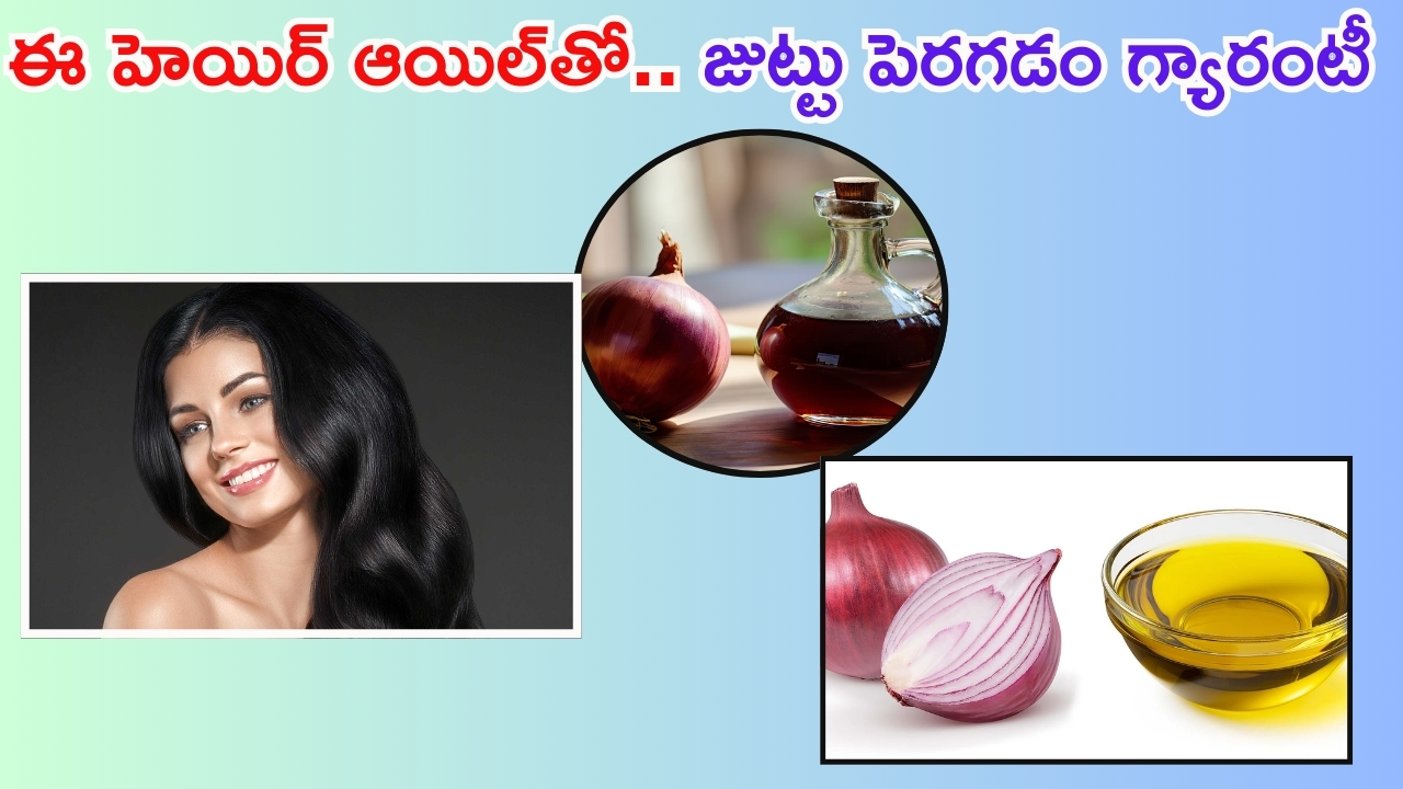 Homemade Onion Oil: ఉల్లిపాయతో ఇలా హెయిర్ ఆయిల్ తయారు చేసుకుని వాడితే.. జుట్టు రాలనే రాలదు